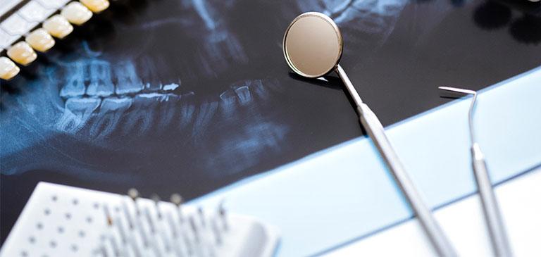 prześwietlenie szczęki